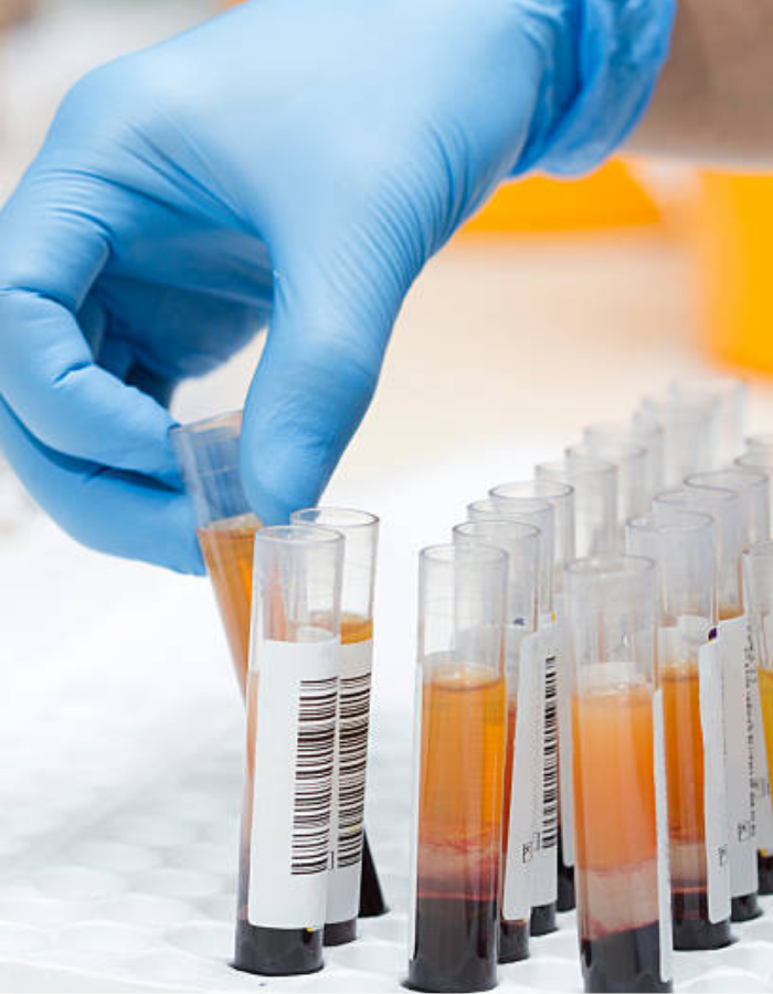 Lab Delivery Medical Courier Services – Knox Courier